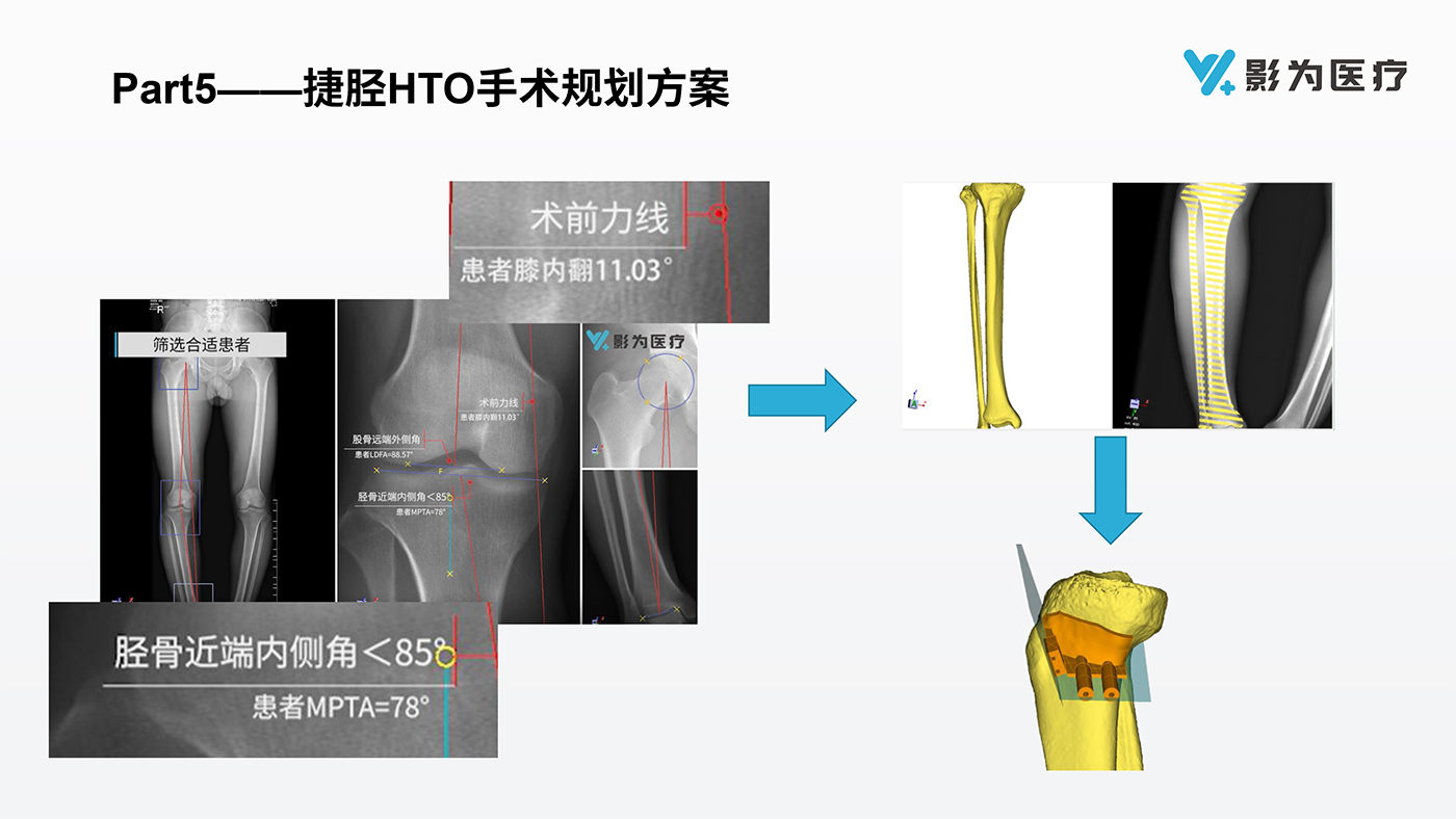 影像科3D打印解決方案