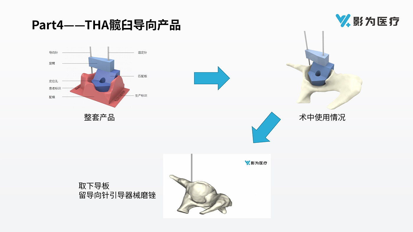 影像科3D打印解決方案